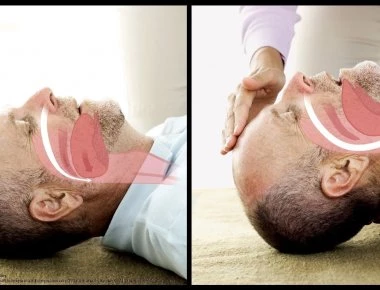 Νευροχειρούργος αποκαλύπτει για τον μύθο «του γύρισε η γλώσσα» - Τι πρέπει να κάνουμε αν συμβεί